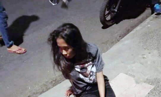 Kaki Putus Tergilas KA, Gadis Berusia 19 Tahun Masih Siuman