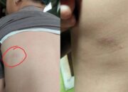 Oknum Guru SDN Sangkali 01 Lakukan Kekerasan Terhadap Siswa Hingga Trauma