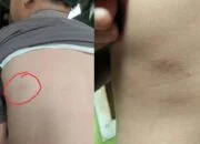 Oknum Guru SDN Sangkali 01 Lakukan Kekerasan Terhadap Siswa Hingga Trauma Oknum Guru SDN Sangkali 01 Lakukan Kekerasan Terhadap Siswa Hingga Trauma