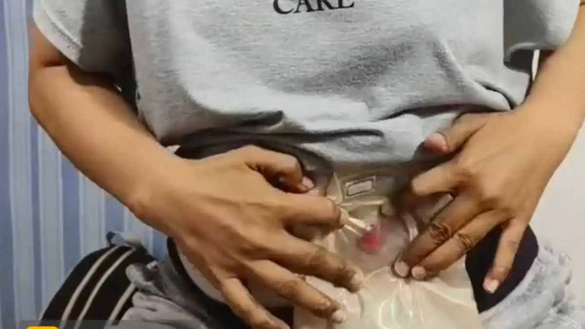 Penyebab Kanker Usus Akibat Gaya Hidup dan Pola Makan Tidak Sehat Penyebab Kanker Usus Akibat Gaya Hidup dan Pola Makan Tidak Sehat